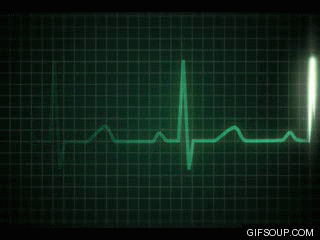 heart-monitor-o
